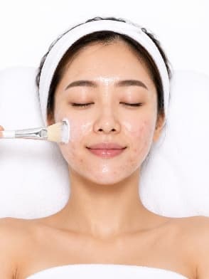 Acne Facial at Alia Wellness Center