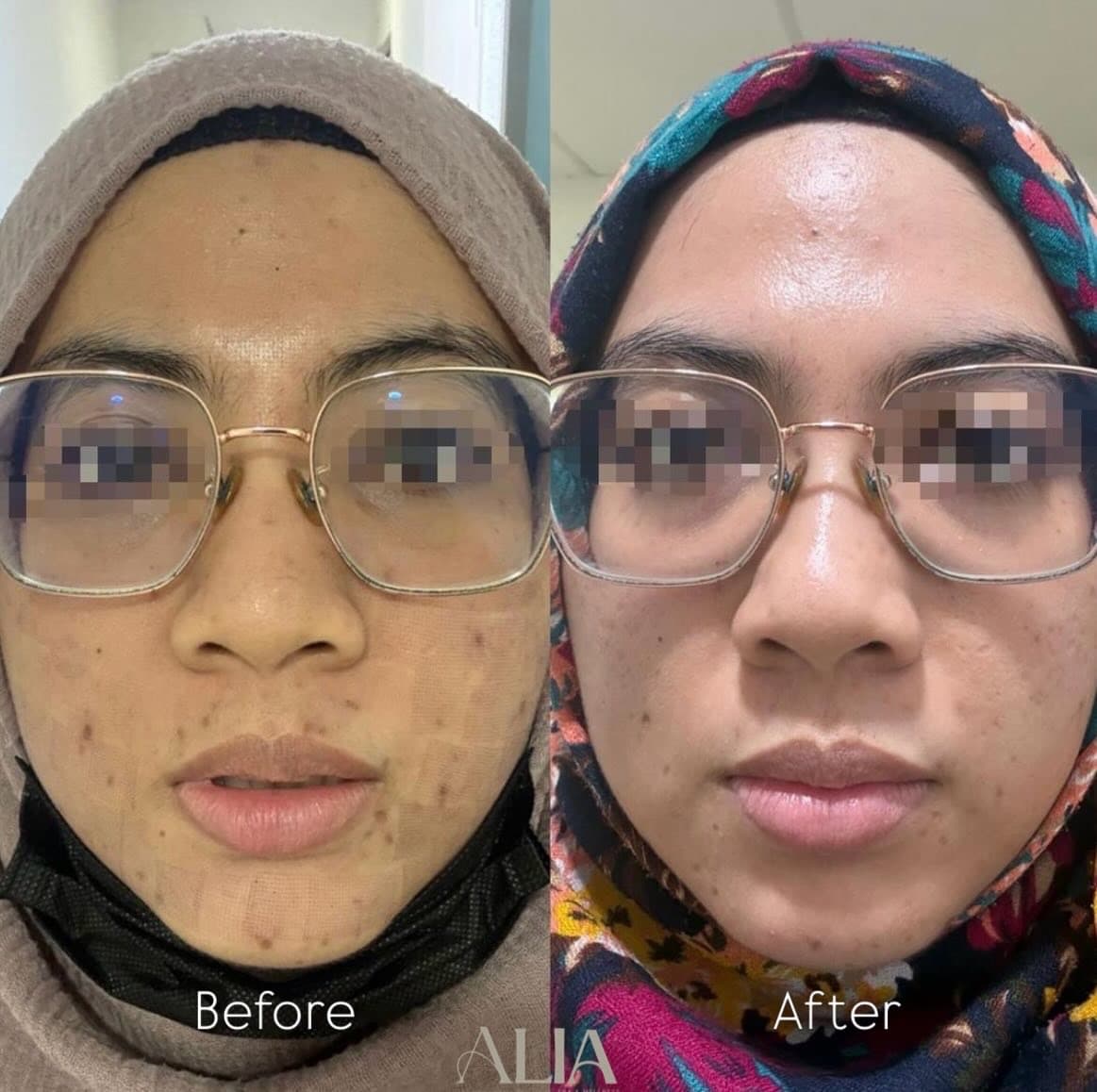 Before and after treatment results